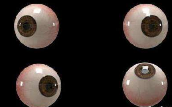 世界首個(gè)3D人工眼球問(wèn)世，數百萬(wàn)人將重見(jiàn)光明