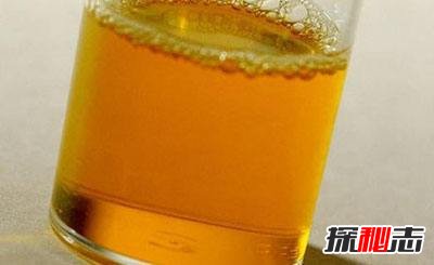 低智商的九種表現